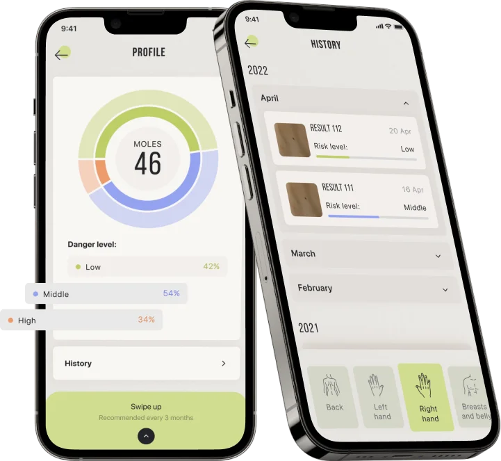 Check Your Birthmark Easily